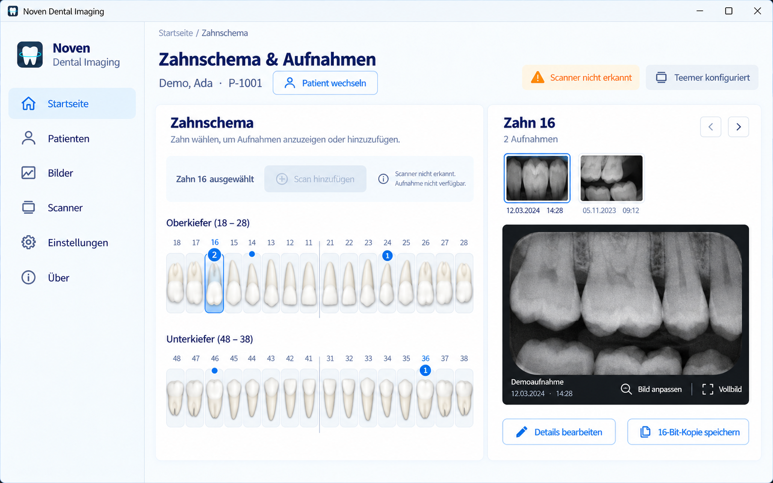 Noven Dental Imaging X-ray review workspace