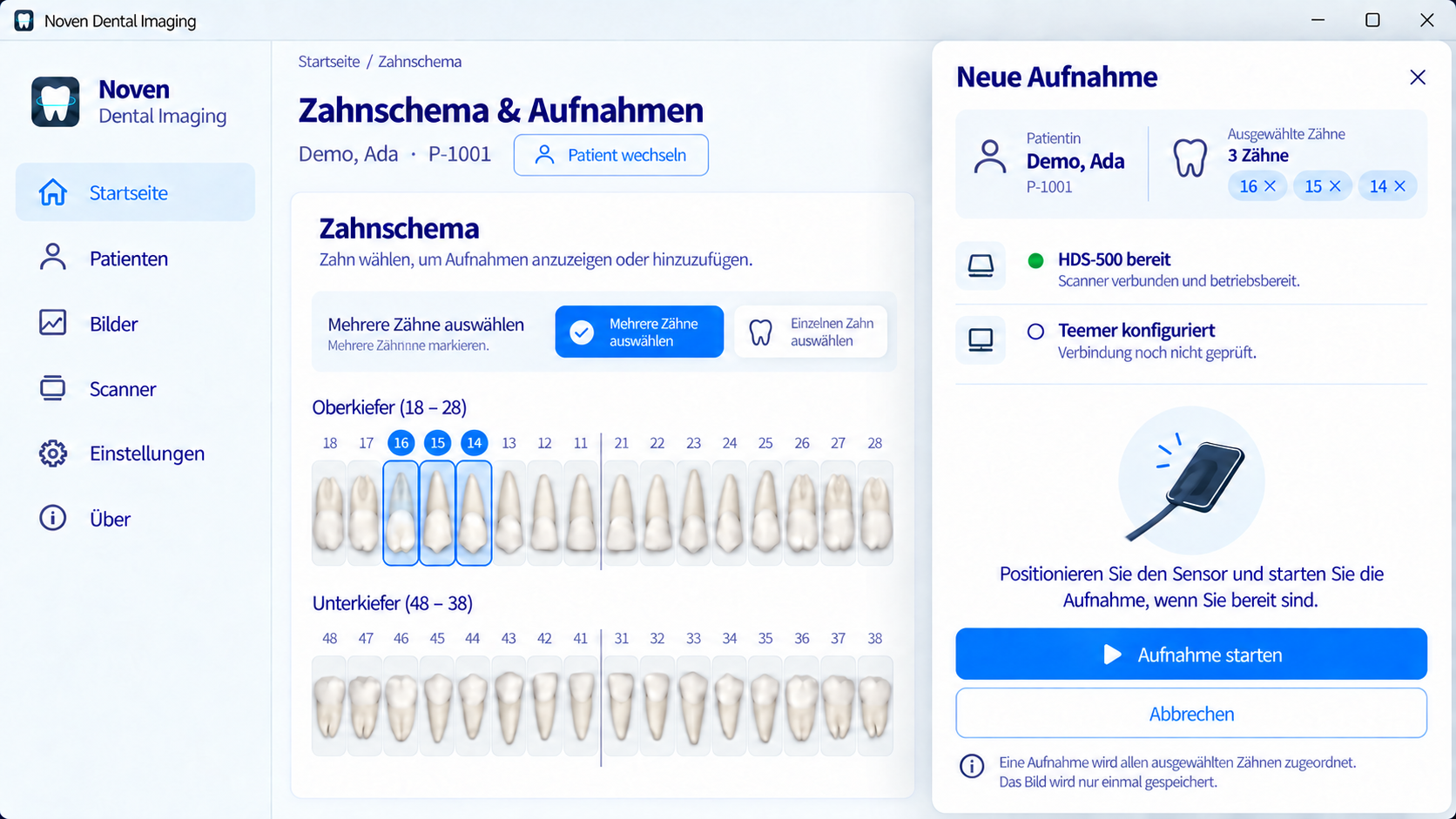 Interactive tooth selection in Noven Dental Imaging